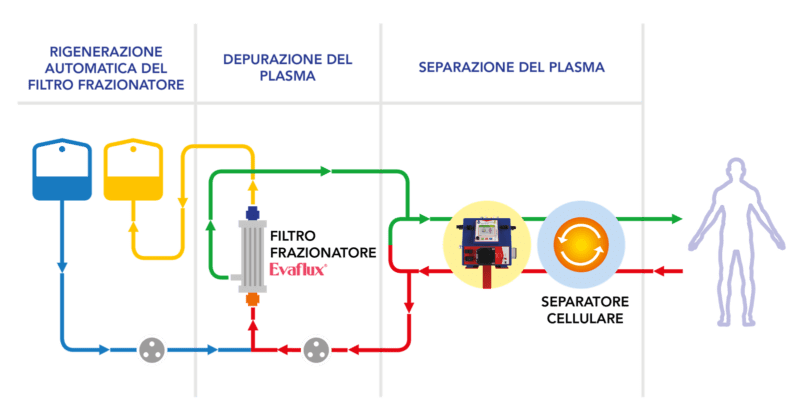 Plasmapher Cascade Filtration (CF)