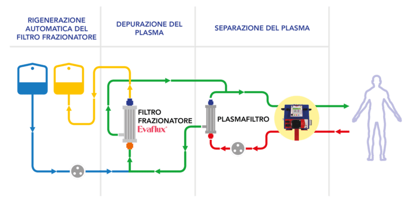 Plasmapher Double Filtration Plasmapheresis (DFPP)