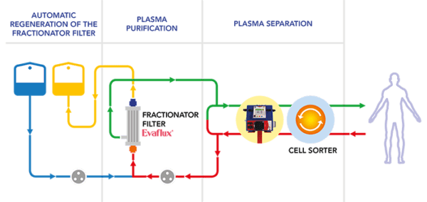 Plasmapher Cascade Filtration